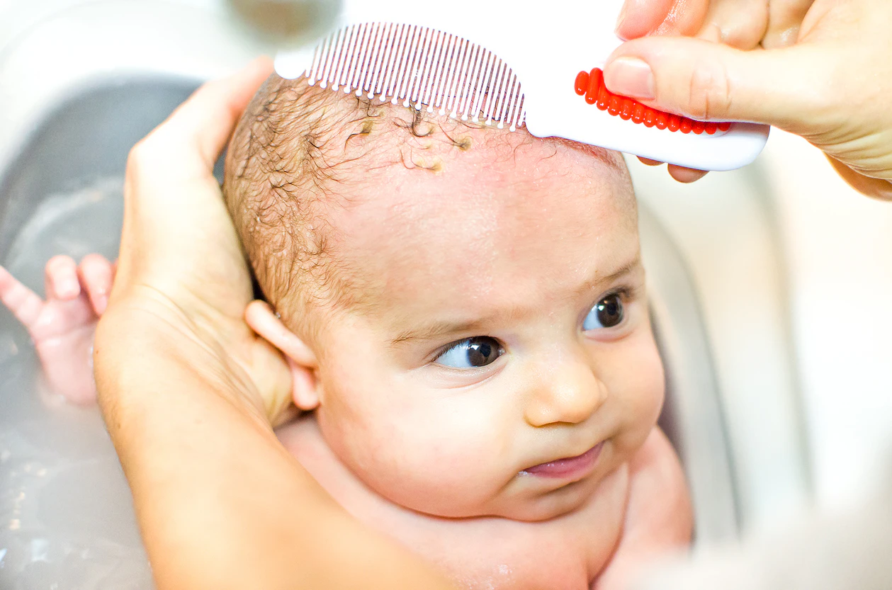 pourquoi bebe a des croutes de lait